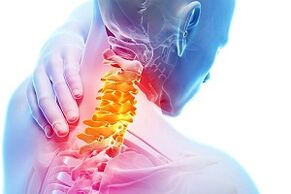 Symptoms of cervical osteochondosis and nutritional rules for the disease