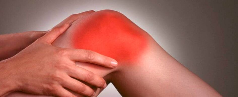 knee joint pain photo 3
