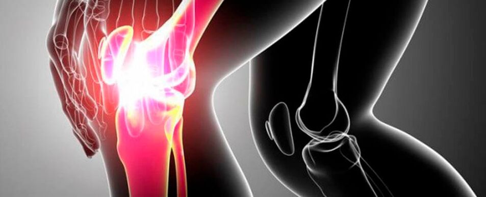 knee joint pain photo 4
